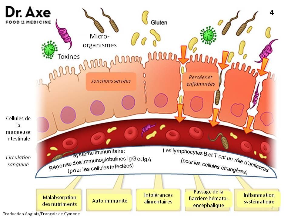 La perméabilité (ou hyperperméabilité) intestinale: schémas à l'appui