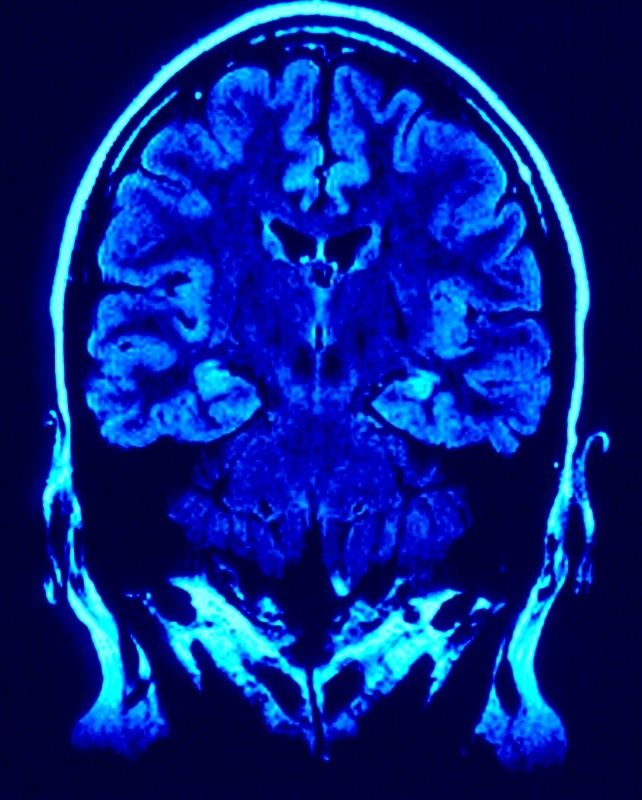 Radio Neurones  la radio de la semaine du cerveau