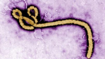 Ebola: un test de diagnostic rapide mis au point en France