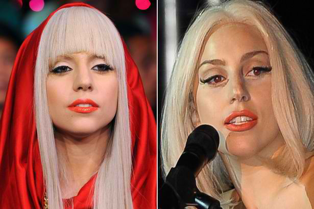 Lady Gaga avant et après chirurgie esthétique