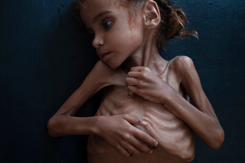 Envoyer un message privé Ob_208a5e_yemen-famine-amal-hussain-c-tyler-hi