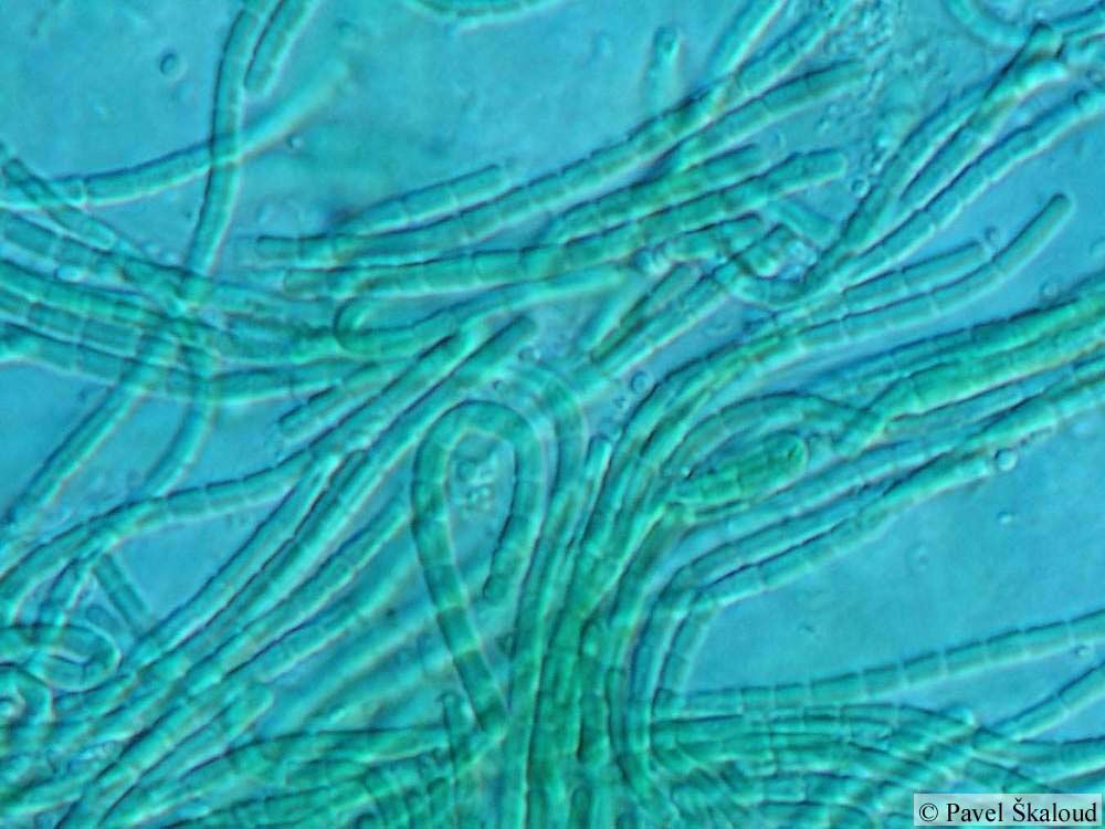 Cyanobactérie de l'espèce Leptolyngbya - doc Pavel Skaloud / cyanodb.cz