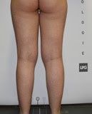 WIM MONACO: ESTHETIQUE DES JAMBES