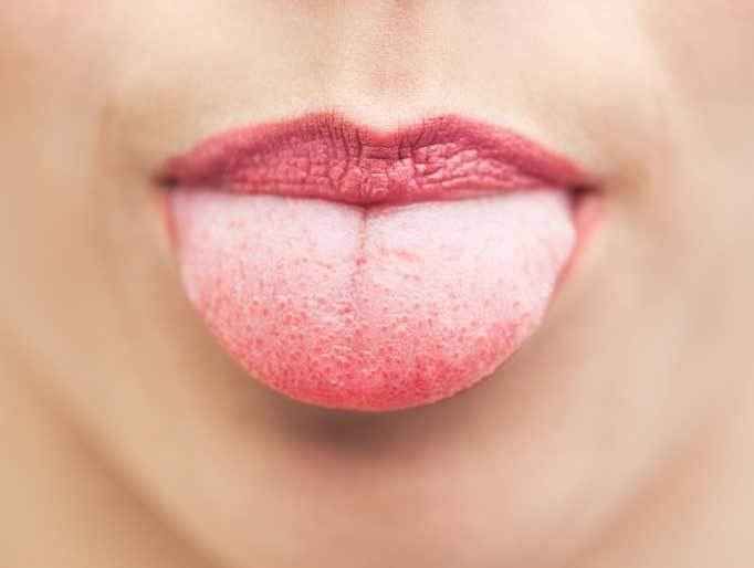 les plaies dans la bouche les plaies dans la bouche