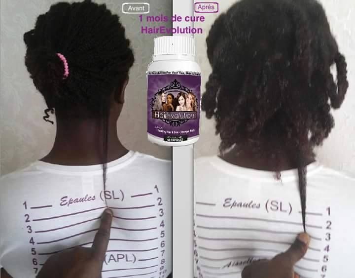 j ai test 233 les compl 233 ments alimentaires hairevolution j ai test 233 les compl 233 ments alimentaires hairevolution