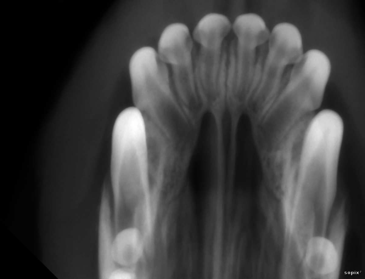 radiographie post opératoire du maxillaire