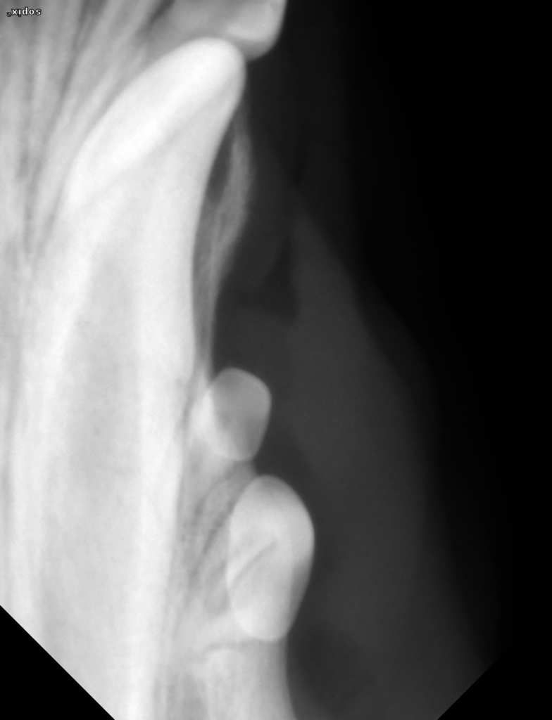 radiographie au site de la dent 404 qui est incluse
