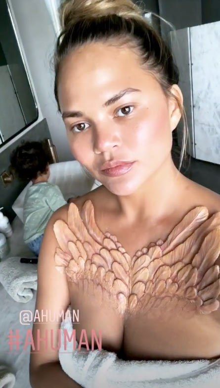 Kim Kardashian se fait poser un implant sous