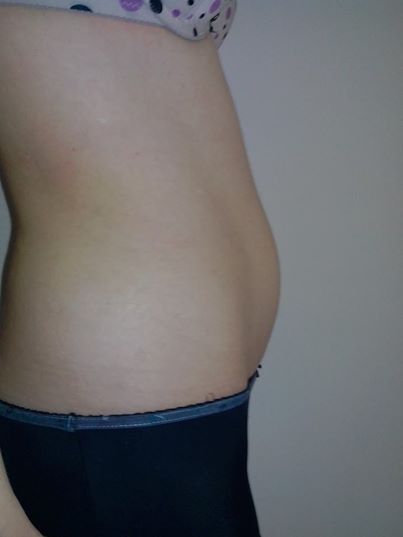 Pourquoi fait mal le dos pendant le rêve chez les femmes enceintes