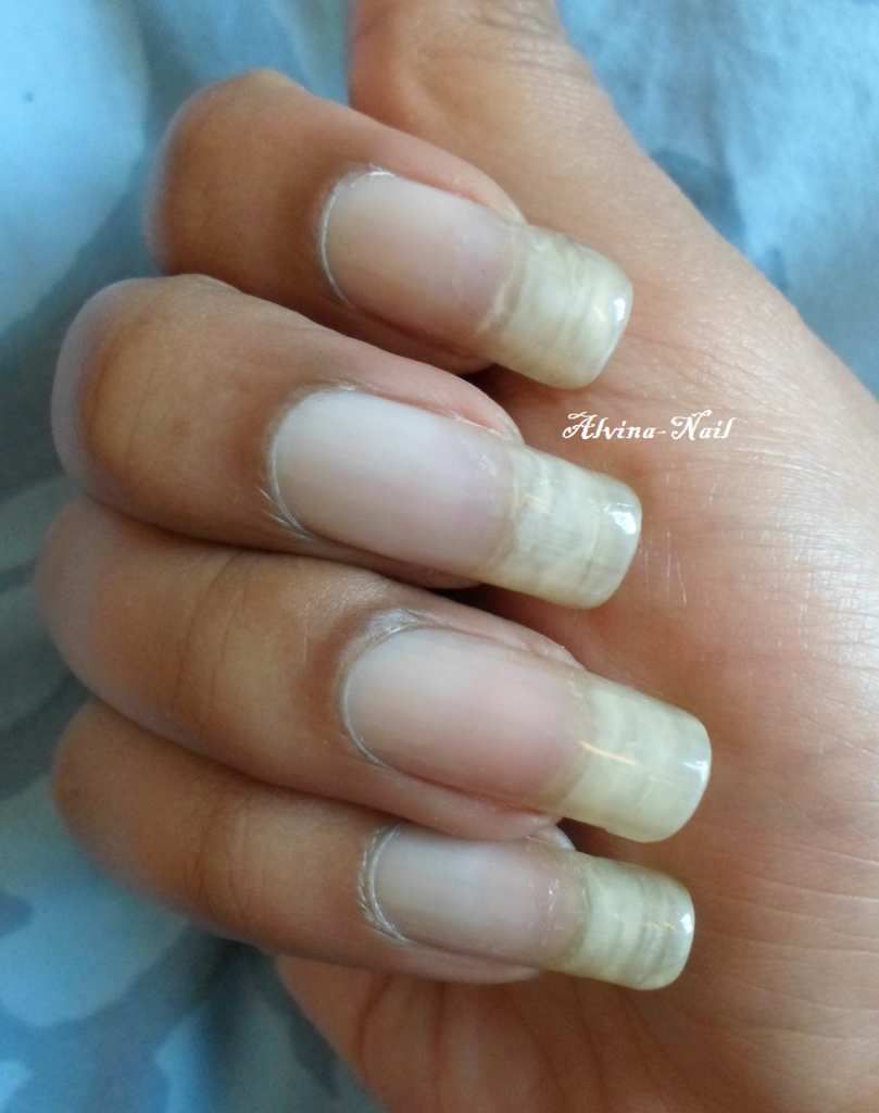 Ongles nus , Janvier 2015