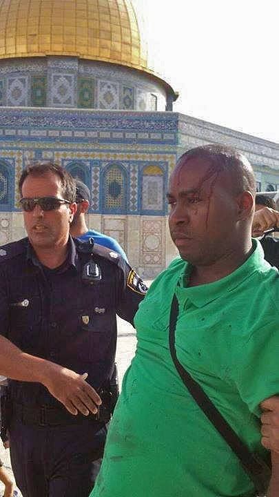 Un touriste espagnol a reçu une pierre sur la tête, il se fait escorter par la police pour échapper à un lynchage cer