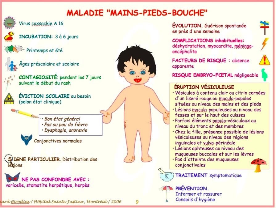 Maladie Main Pied Bouche Chez L Adulte