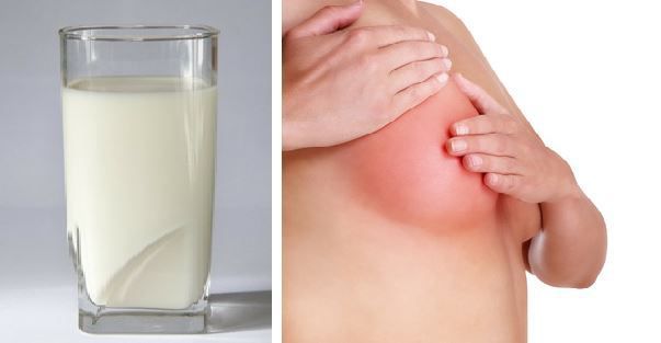 Soda and breast lumps