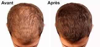 Le masque lhumectation des cheveu la recette les rappels