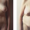 Before and After @ Martha Wilson. 1974-2008