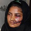 Femmes martyre 1