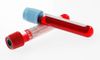 Le grand test du glucose