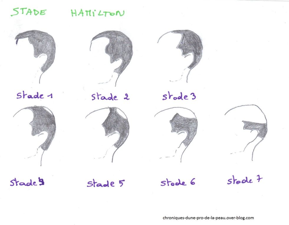 Le vinaigre de pomme le masque sur les cheveux