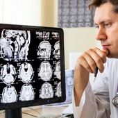 Curcuma versus fluor ou comment protéger votre cerveau
