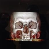 Imprimante 3D : Que de chemin parcouru ... depuis le "Allo Houston ... passez-moi la clé de 12" à la chirurgie maxillo-faciale ! - OOKAWA Corp.