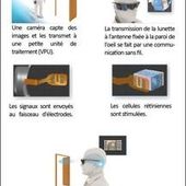 Bionic Eye : Second Sight FR 2012 Argus II Retinal Prosthesis System - Artificial Retina - OOKAWA Corp.