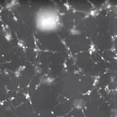 VIDEO. La danse endiablée de cellules souches qui se changent en neurones - OOKAWA Corp.