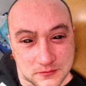 Un biohacker s'injecte un liquide dans les yeux pour voir dans le noir - OOKAWA Corp.