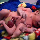 Naissance de milliers d'enfants malformés en Irak: l'OMS censure son propre rapport!!