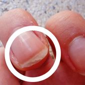 Pourquoi les ongles se dédoublent-ils ? Les causes, les traitements et les solutions - Améliore ta Santé