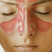 Remedio para curar la infección sinusal - Salud & Belleza Natural