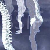 SPA... Arthrite Psoriasique... Polyarthrite Rhumatoïde...