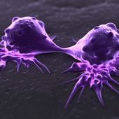 Cancer : une nouvelle molécule pour "affamer" les tumeurs - cancer santé médecines alternatives