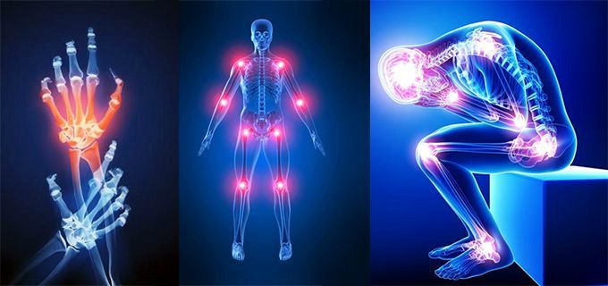 ¿Por qué la fibromialgia duele más por la noche?