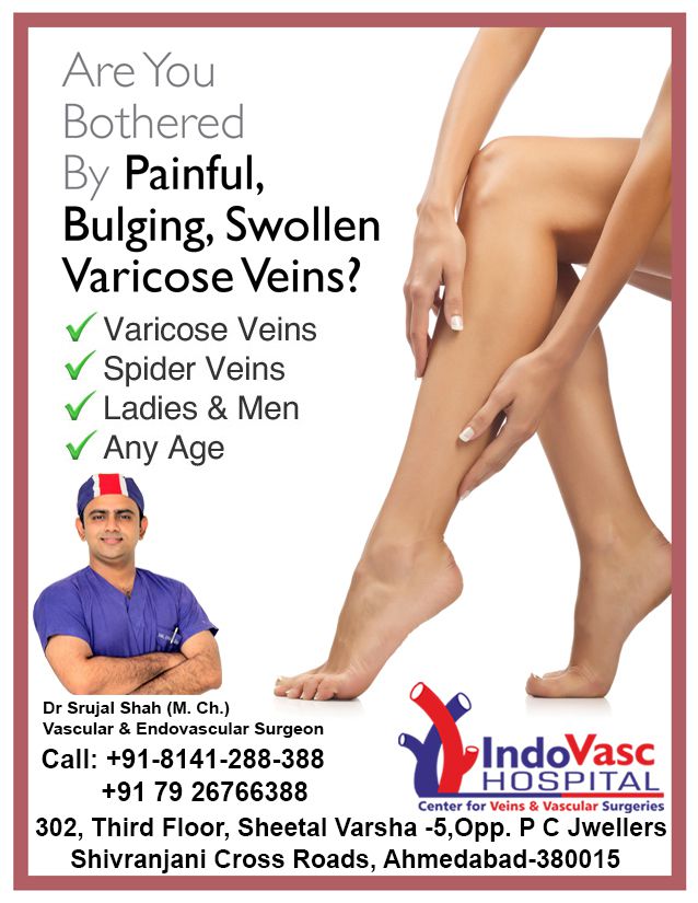 Vaginal varicose vein  best hospital for varicose veins treatment in  Ahmedabad, India 