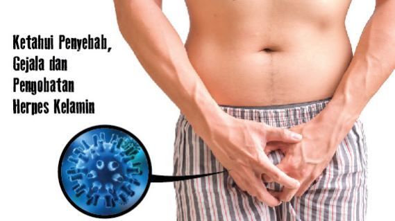 Foto cara mengobati herpes pada kelamin pria