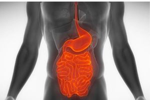 Les maladies chroniques intestinales. MICI (Crohn et recto-colite hémorragique) des solutions. Des guérisons ?