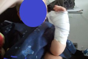 Un accident est si vite arrivé...