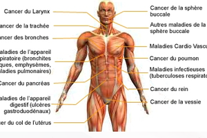 Maladies et affections liées au tabac