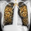 Toujours plus de maladies causées par le tabac