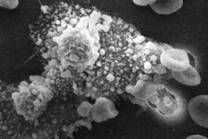 La causa principal de cáncer: alimentos con agroquímicos