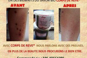 Beauté & santé corporelle:Un savon Bio qui soulage des femmes en ce moment.