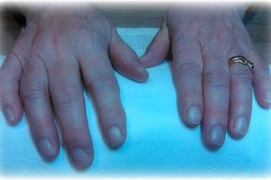 embellissement d'ongles naturels avant/apres