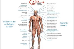 Workshop Laser et Médical - Micronora 2016 | Programme & Inscription