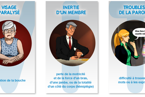 Vivre le quotidienne avec un AVC