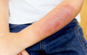 Partie 4 : Approche des soins en médecine, chirurgie, pédiatrie et en réanimation
