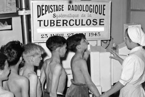 La tuberculose