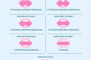 Soulager les poussées dentaires