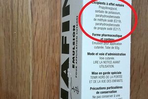 Soigner les brûlures ?!?