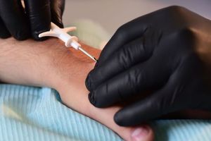 Belgique : des salariés se font implanter une puce électronique sous la peau