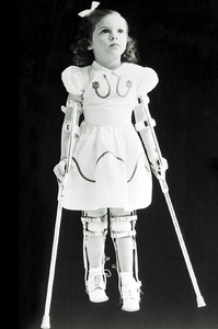 Polio (2/4) : la polio c'est quoi ?